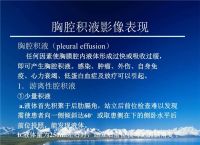 [effusion翻译]effusions翻译