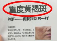 女人气血足了脸上还会长斑吗,女性气血足了后能淡面部黄褐斑吗