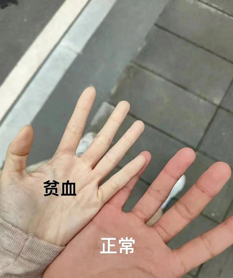 气血足的人的手,气血不足手部会有什么症状