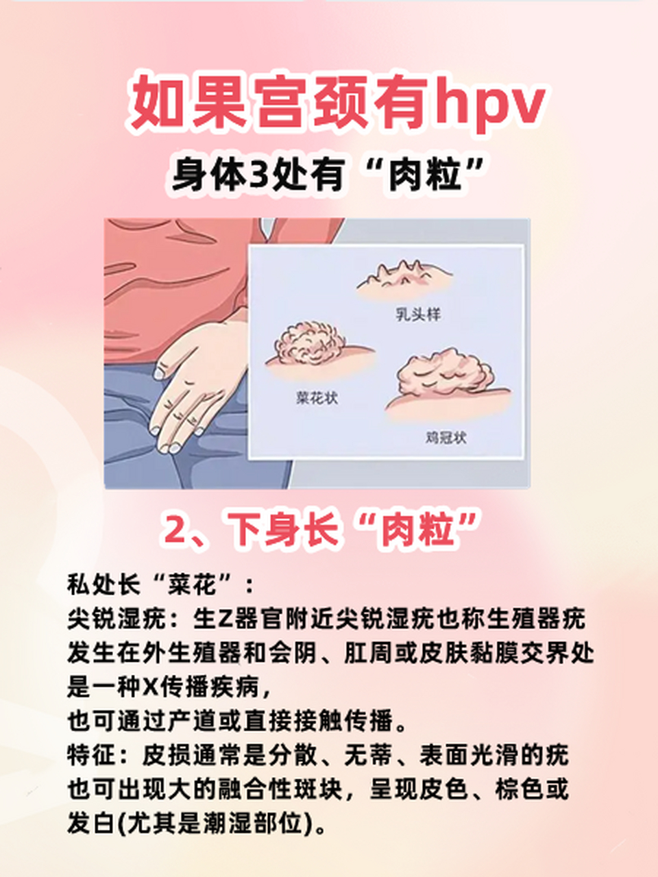 女人感染hpv最明显的迹象,女人感染了hpv病毒的症状是什么